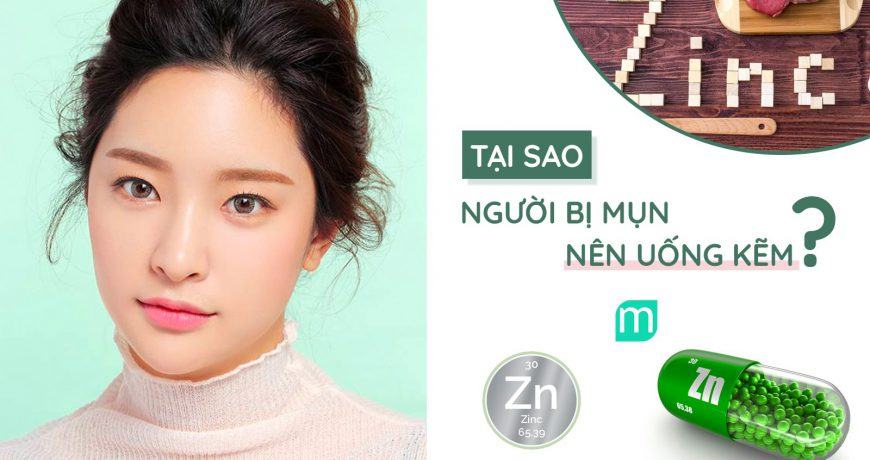 tai-sao-nguoi-bi-mun-nen-uong-kem tai-sao-nguoi-bi-mun-nen-uong-kem.jpg