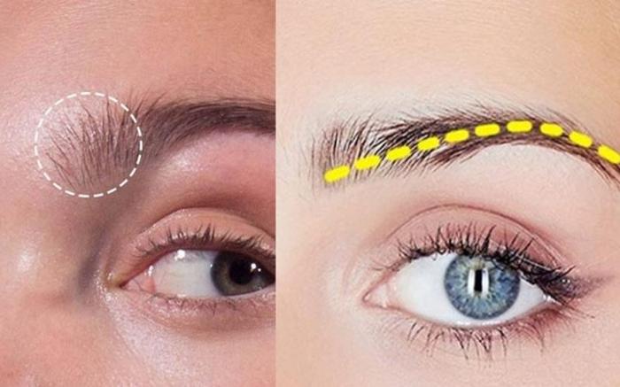 Lông mày, tóc tai và tóc gáy đứng bất thường