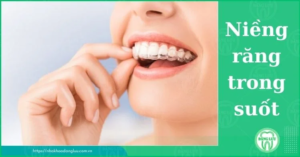 Ưu điểm của niềng răng trong suốt? Niềng răng có hiệu quả không? nieng-rang-trong-suot