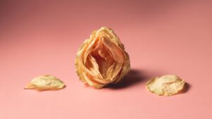 Âm đạo bị khô phổ biến với phụ nữ mãn kinh