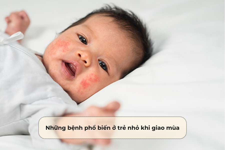 Những bệnh phổ biến ở trẻ nhỏ khi giao mùa