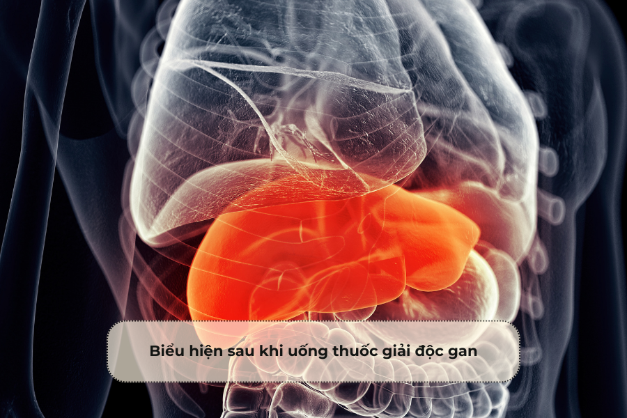 Biểu hiện sau khi uống thuốc giải độc gan
