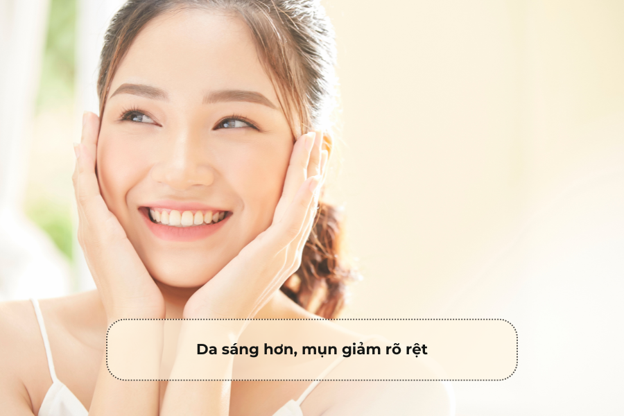 Da sáng hơn, mụn giảm rõ rệt