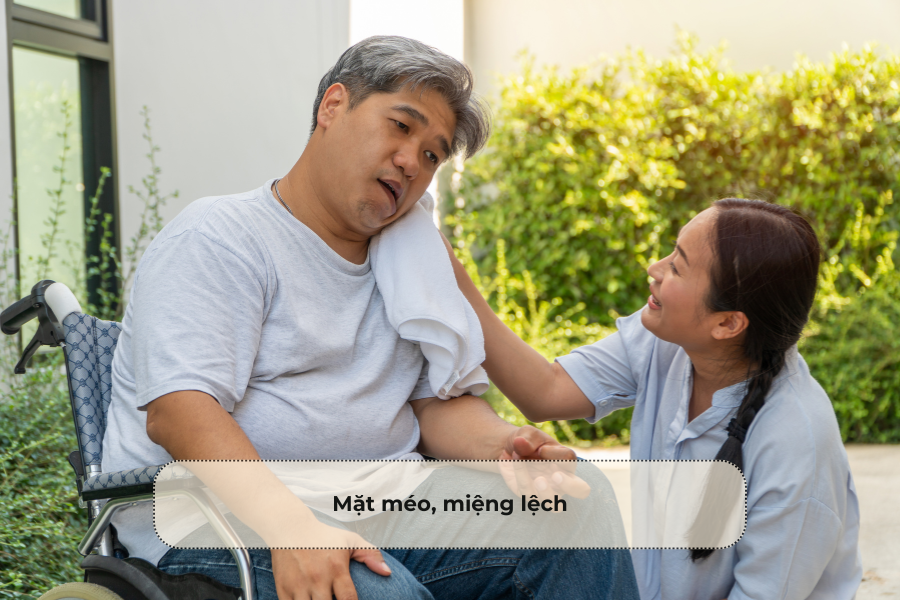 Mặt méo, miệng lệch