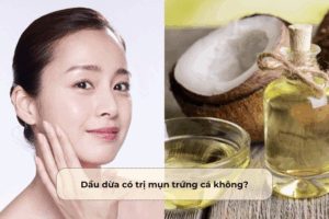 Giải đáp: Dầu dừa có trị mụn trứng cá không? Dầu dừa có trị mụn trứng cá không
