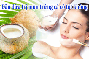 Dầu dừa có trị mụn trứng cá không​