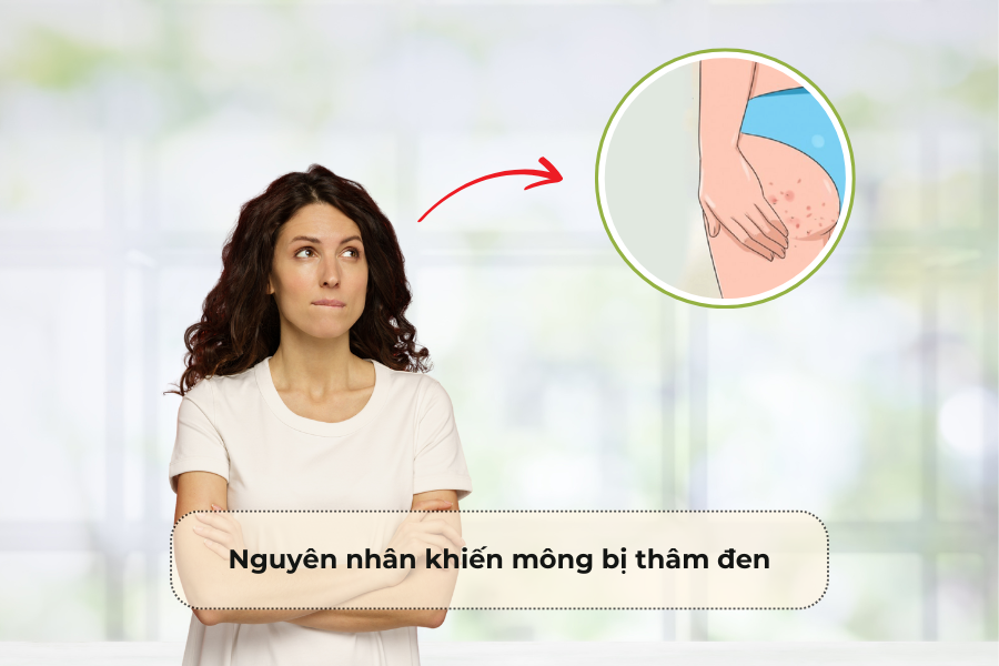 Nguyên nhân khiến mông bị thâm đen