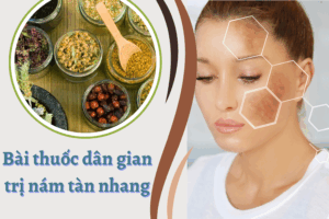 Bài thuốc dân gian trị nám tàn nhang: Liệu có thực sự hiệu quả? Bài thuốc dân gian trị nám tàn nhang