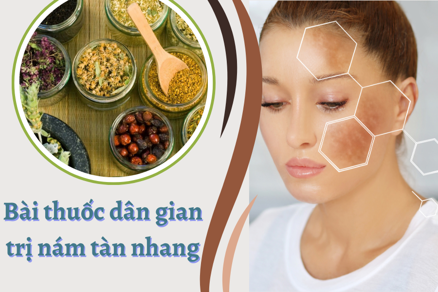 Bài thuốc dân gian trị nám tàn nhang