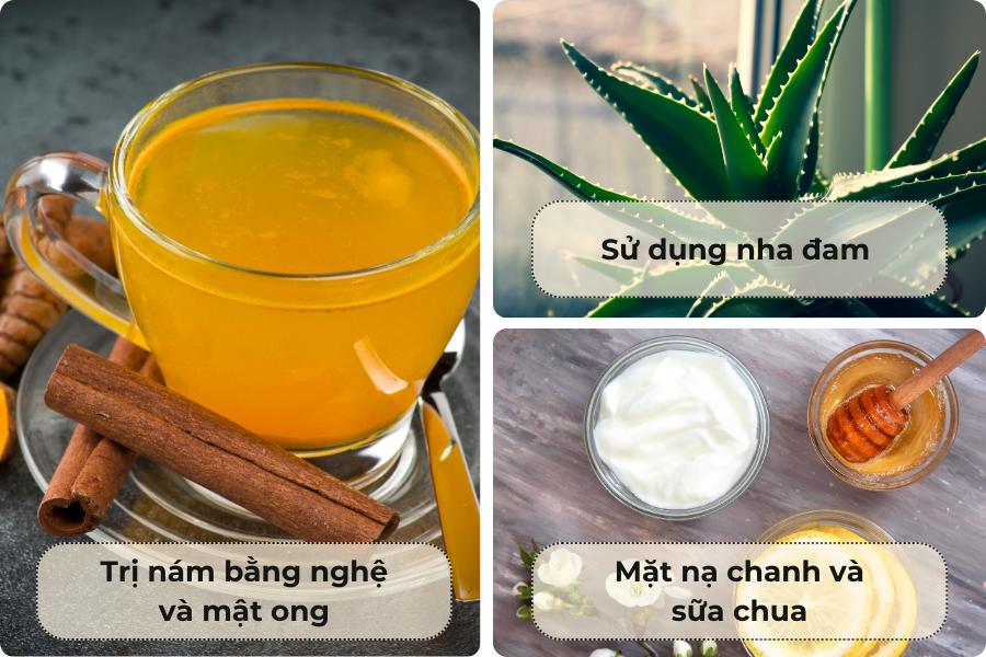 Một số bài thuốc dân gian trị nám, tàn nhang phổ biến