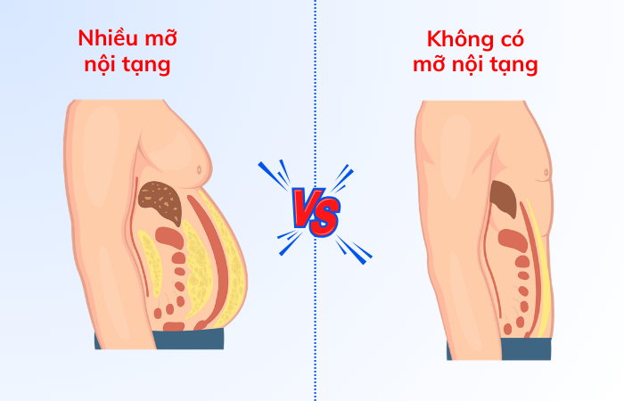 Mỡ nội tạng ở vùng bụng làm mỡ bụng khó giảm