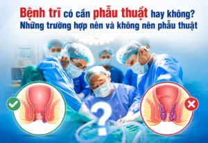 Bệnh trĩ có cần phẫu thuật hay không? Những trường hợp nên và không nên phẫu thuật