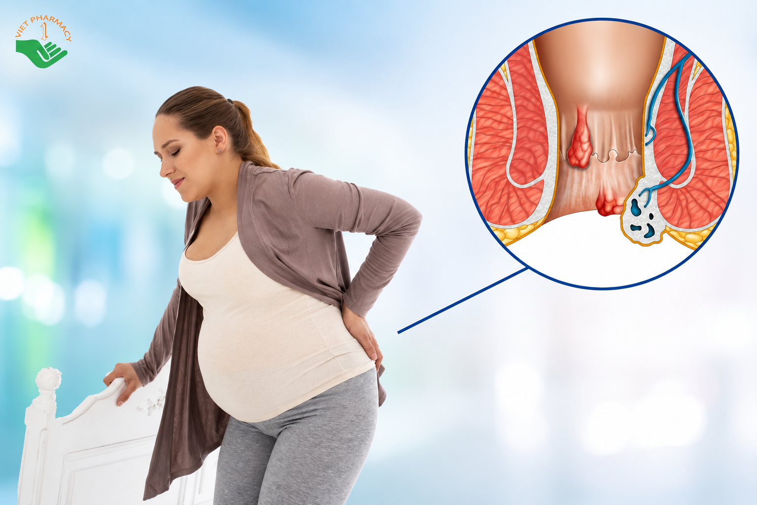 Vì sao bà bầu dễ bị trĩ?
