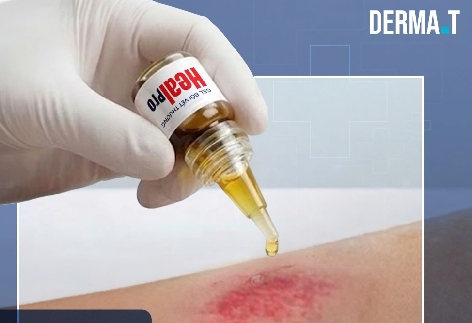 Nhỏ gel theo từng giọt tuỳ vào diện tích miệng vết thương